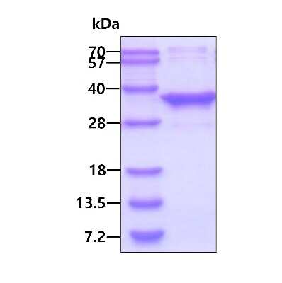 SDS-PAGE: Recombinant Human MMACHC His Protein [NBP1-98954]